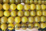 LSBS428 15 inches 20mm round agate gemstone beads wholesale